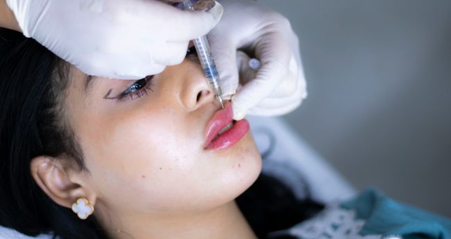 Lip fillers treatment at vishka skincare