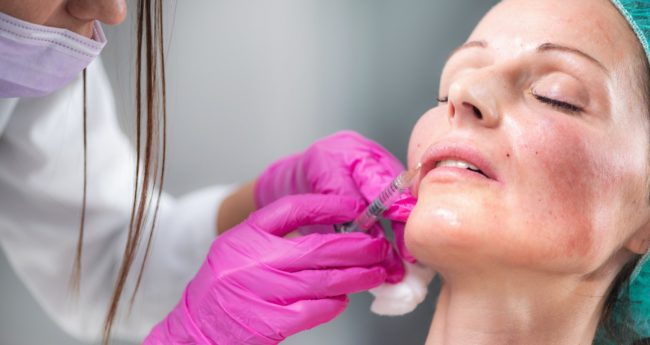 Dermal FillerTreatment at Vishka Skincare